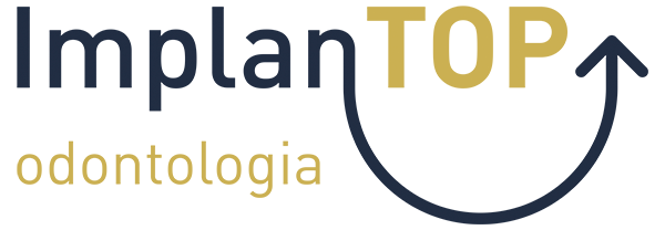 ImplanTOP